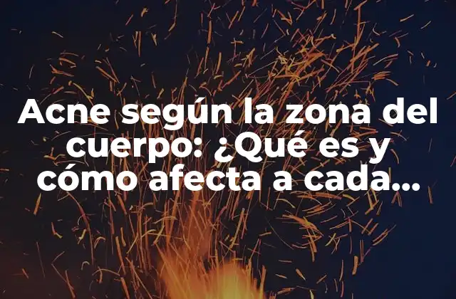 Acne según la Zona Del Cuerpo: ¿qué es y Cómo Afecta a Cada Área?