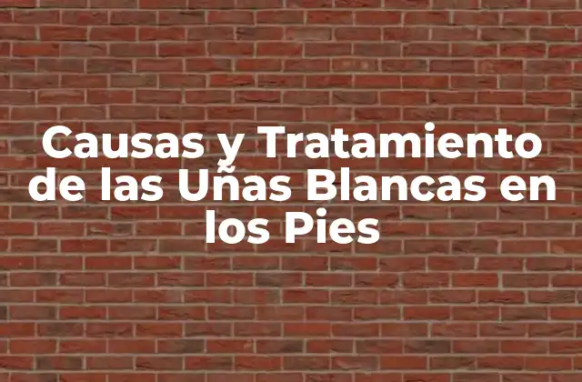 Causas y Tratamiento de las Uñas Blancas en los Pies