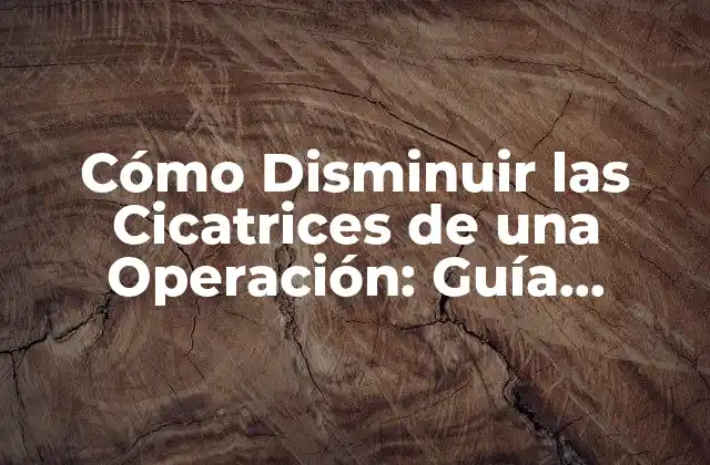 Cómo Disminuir las Cicatrices de una Operación: Guía Completa y Actualizada