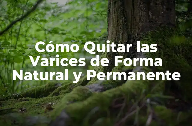 Cómo Quitar las Varices de Forma Natural y Permanente