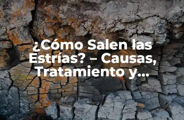 ¿cómo Salen las Estrías? – Causas, Tratamiento y Prevención