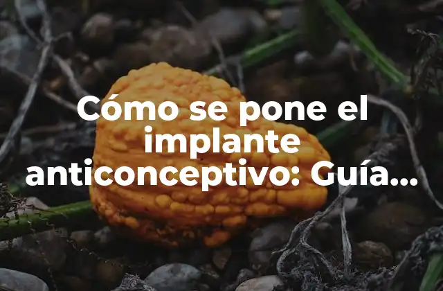 Cómo Se Pone el Implante Anticonceptivo: Guía Detallada y Completa