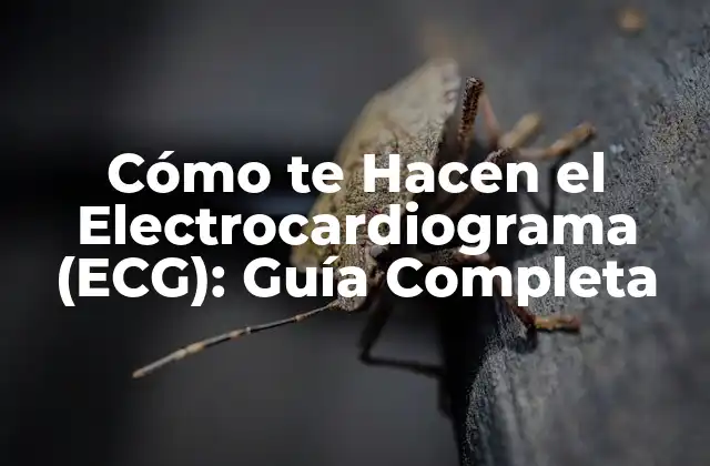 Cómo Te Hacen el Electrocardiograma (ecg): Guía Completa