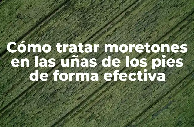 Cómo Tratar Moretones en las Uñas de los Pies de Forma Efectiva 2 Causas de los moretones en las uñas de los pies