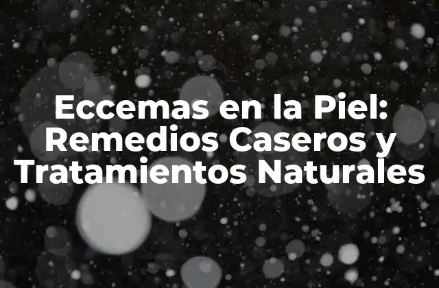 Eccemas en la Piel: Remedios Caseros y Tratamientos Naturales