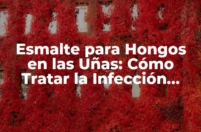 Esmalte para Hongos en las Uñas: Cómo Tratar la Infección Fúngica con Éxito
