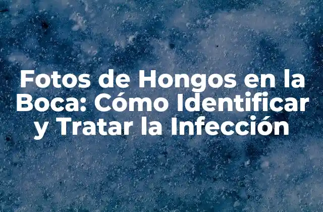 Fotos de Hongos en la Boca: Cómo Identificar y Tratar la Infección