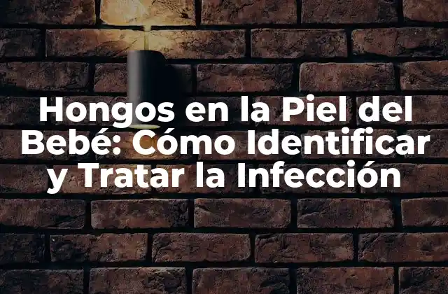 Hongos en la Piel Del Bebé: Cómo Identificar y Tratar la Infección