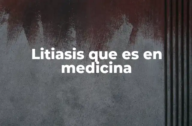 Litiasis que es en Medicina