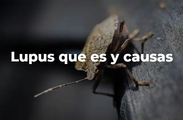 Lupus que es y Causas