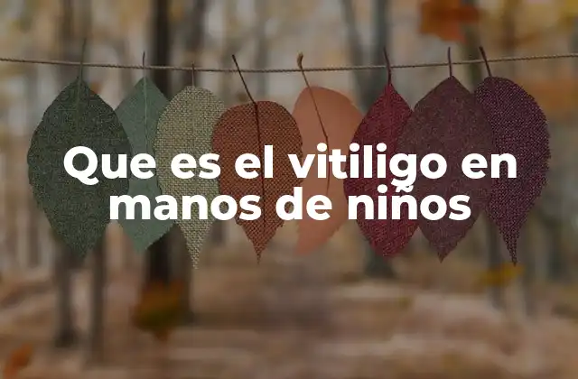 Que es el Vitiligo en Manos de Niños 2 Síntomas del vitiligo en manos de los niños