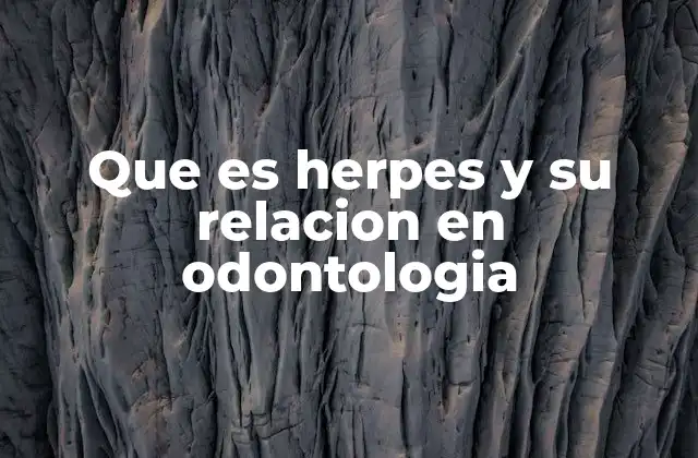 Que es Herpes y Su Relacion en Odontologia