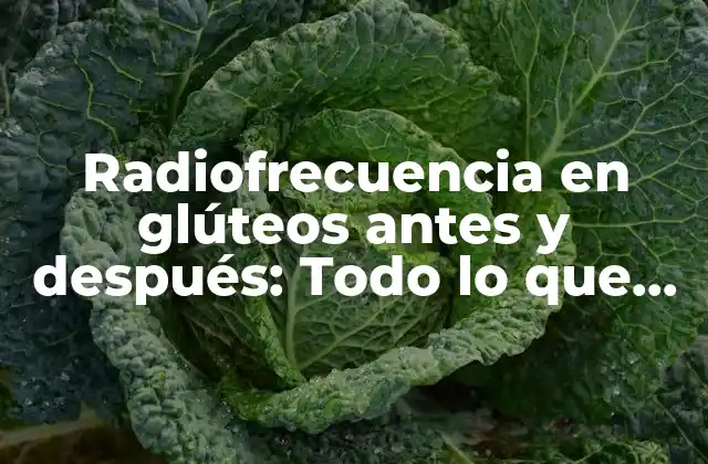 Radiofrecuencia en Glúteos Antes y Después: Todo Lo que Necesitas Saber