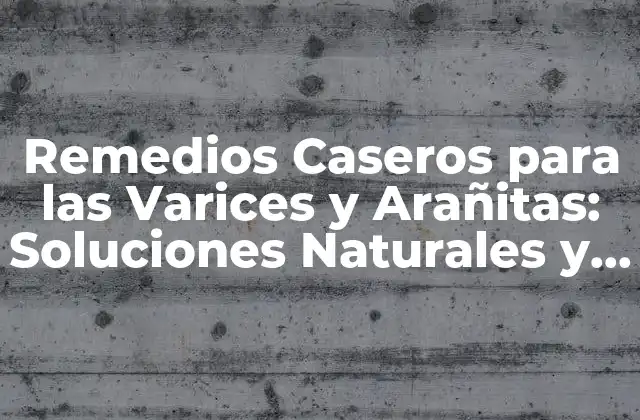 Remedios Caseros para las Varices y Arañitas: Soluciones Naturales y Efectivas