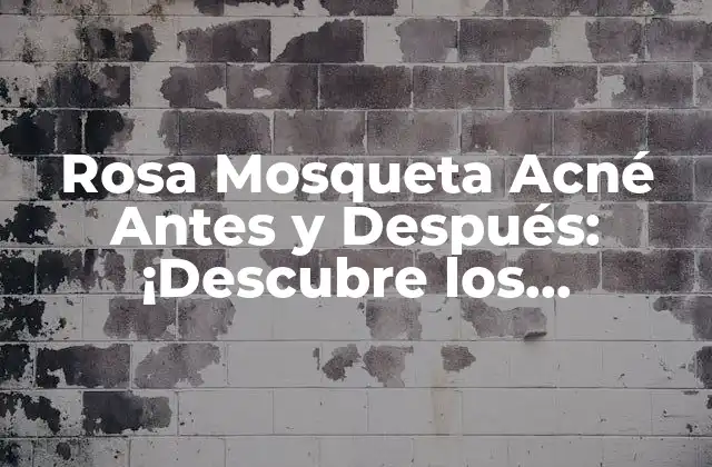 Rosa Mosqueta Acné Antes y Después: ¡descubre los Resultados Sorprendentes!