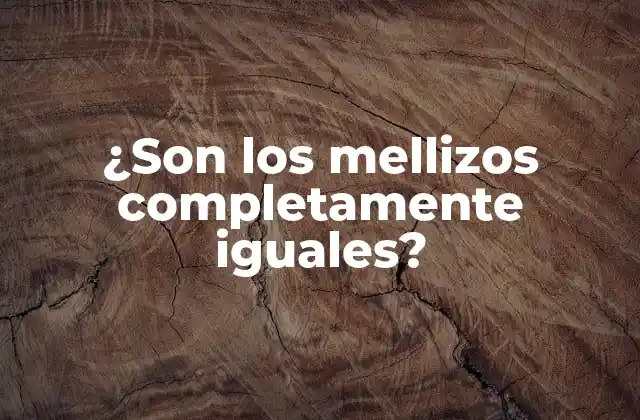 ¿son los Mellizos Completamente Iguales?