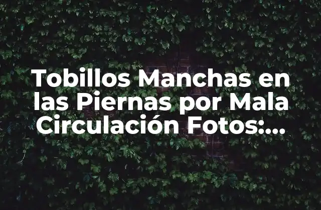 Tobillos Manchas en las Piernas por Mala Circulación Fotos: ¿qué Son y Cómo Tratarlas?