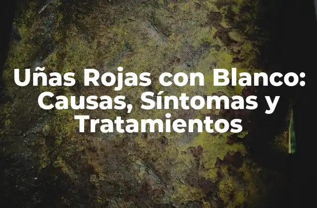 Uñas Rojas con Blanco: Causas, Síntomas y Tratamientos